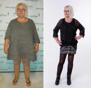 Nurse Loses 65 Pounds With NLP