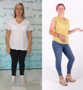 Sharon's Weight Loss Story