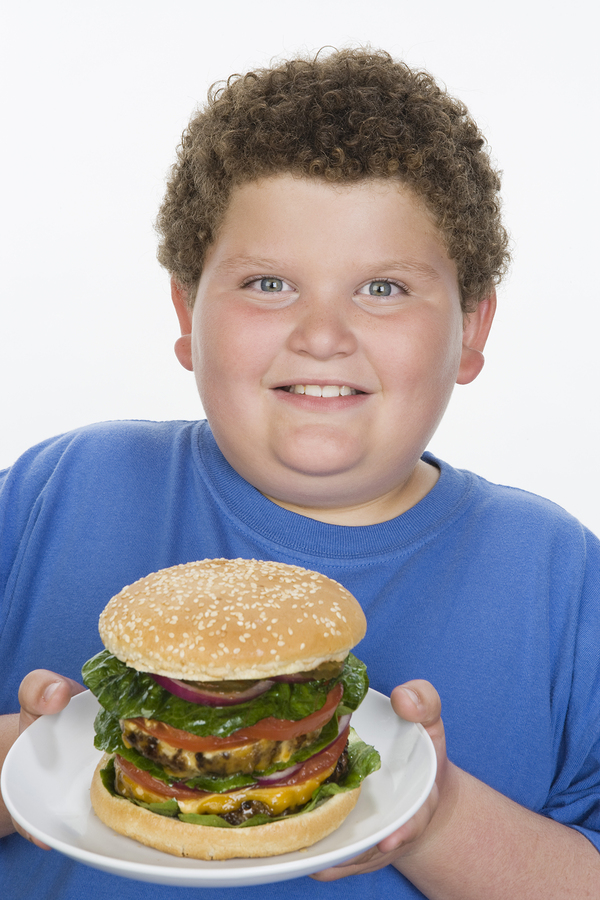 Obese Children need to exercise