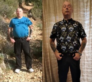 How to Reverse Fatty Liver Disease