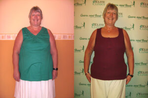 Reversing Type 2 Diabetes