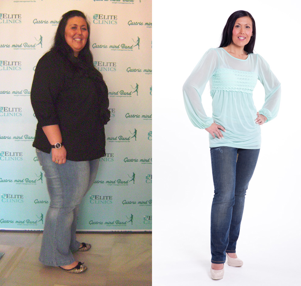 Weight Loss Success with Hypnotherapy