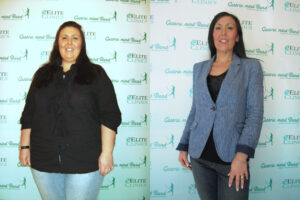 Hypnotherapy to lose weight