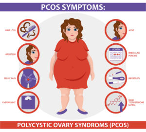 Everything You Need To Know for PCOS Weight Loss
