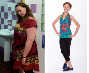 Can I lose Weight Weight Without Bariatric Surgery - What Can I Do Instead of Weight Loss Surgery