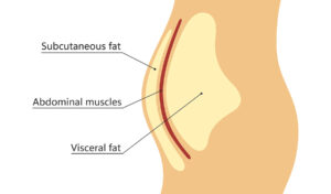 obesity and the heart 